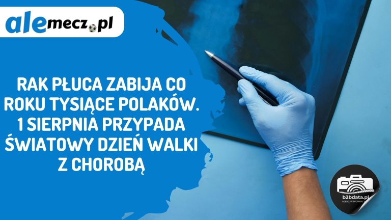 Rak płuca zabija co roku tysiące Polaków. 1 sierpnia przypada Światowy Dzień walki z chorobą